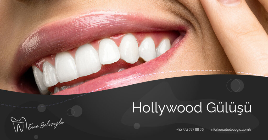 Hollywood Gülüşü