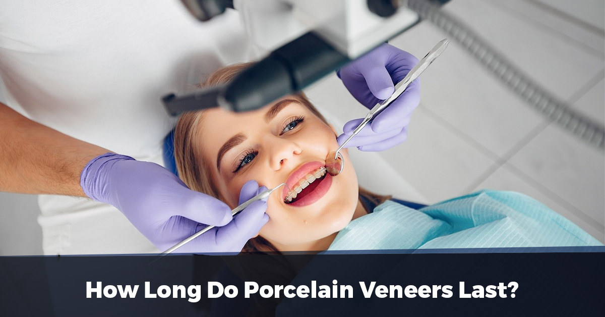 How Long Do Porcelain Veneers Last
