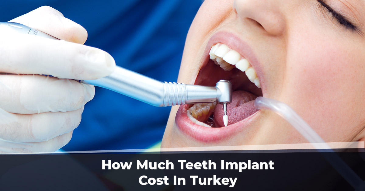 How Much Teeth Implant Cost In Turkey