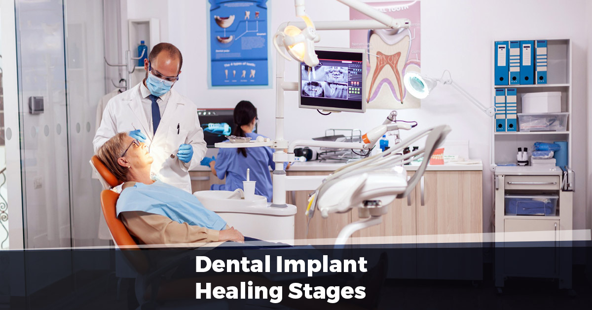 Dental Implant Healing Stages Eating After The Implant Screw is Inserted