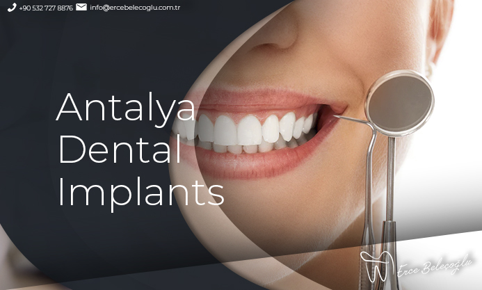 Antalya Dental Implants