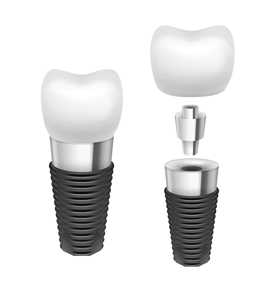 Dental implant Istanbul