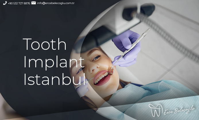 Tooth Implant Istanbul