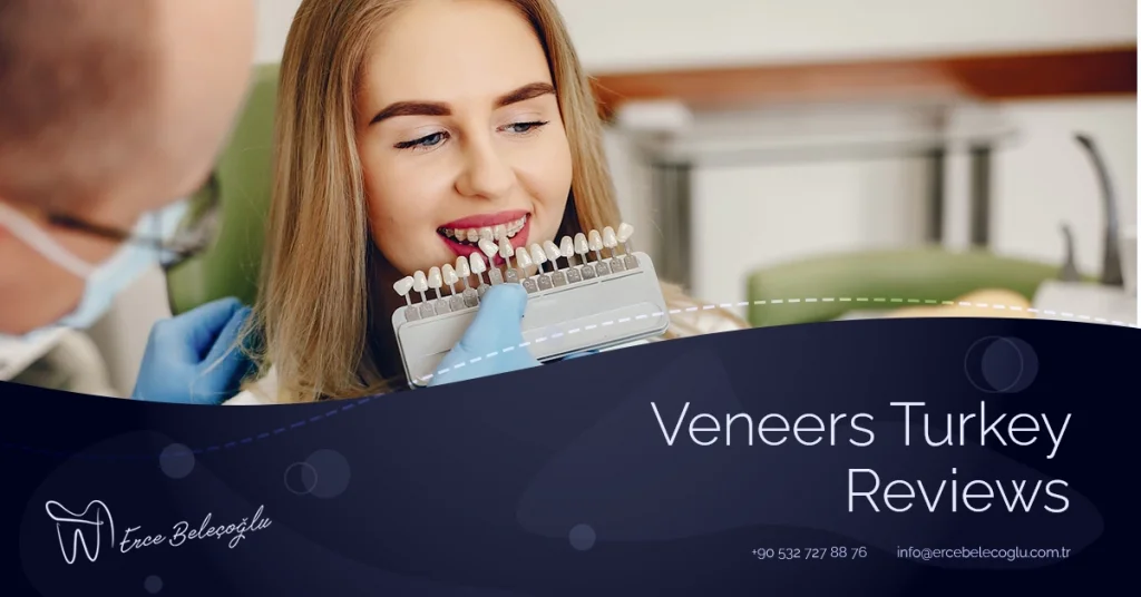 Dental Veneers Turkey Reviews