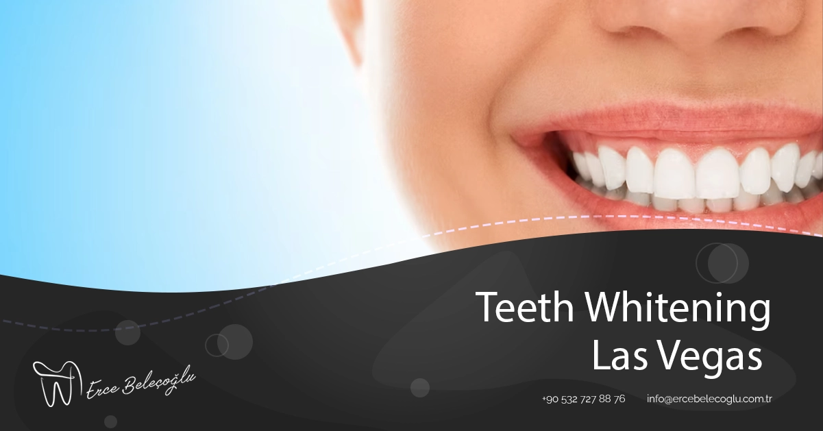 Teeth Whitening Las Vegas Teeth Whitening Cost