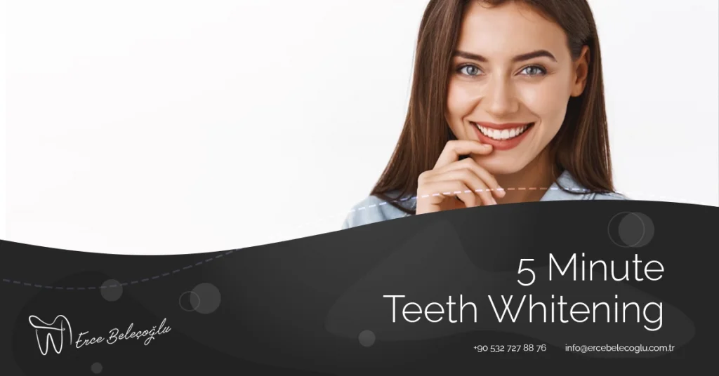 5 Minute Teeth Whitening
