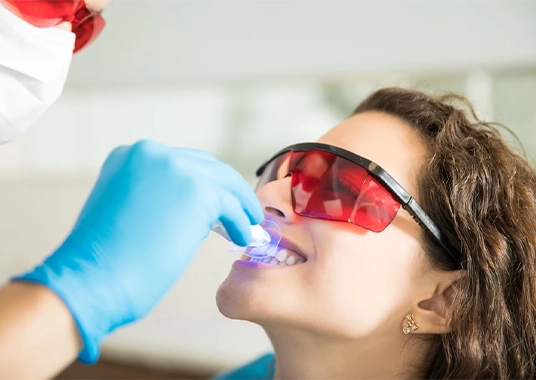 teeth-whitening-mouth-guard