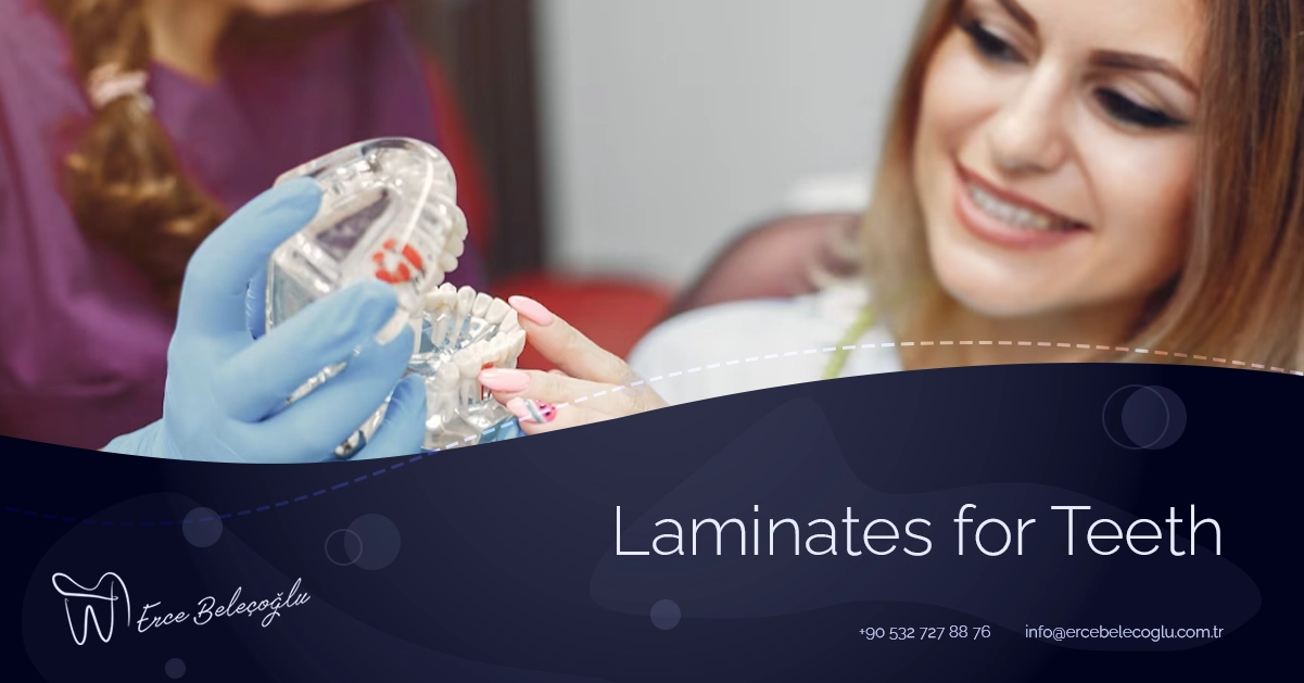 Laminates for Teeth