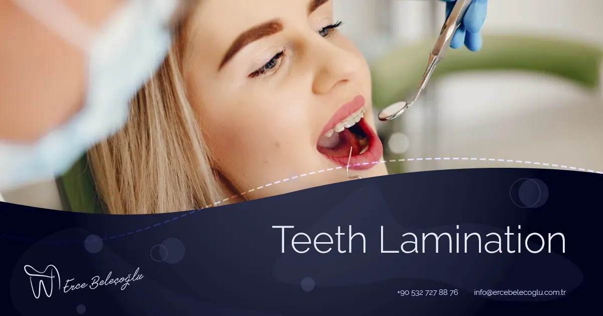 Teeth Lamination