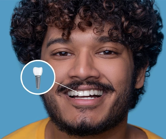 what-are-dental-implants-made-of