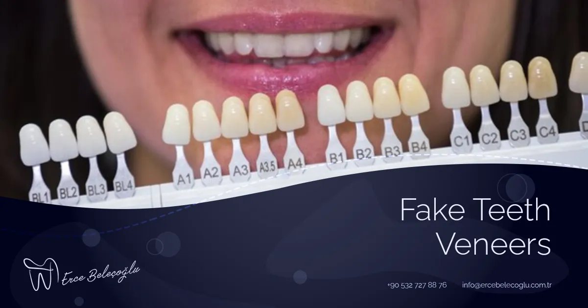 Fake Teeth Veneers