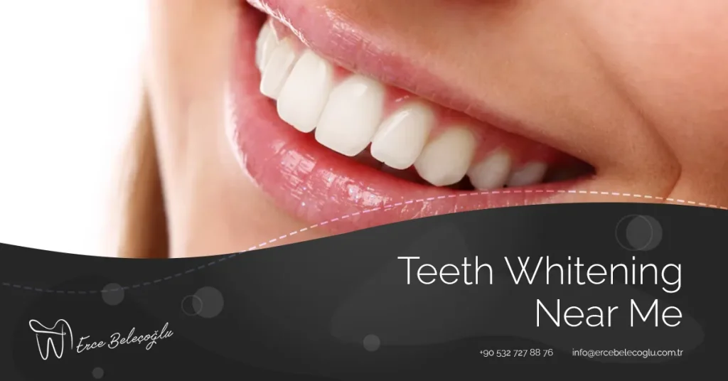Teeth Whitening Near Me Zoom Teeth Whitening Near Me