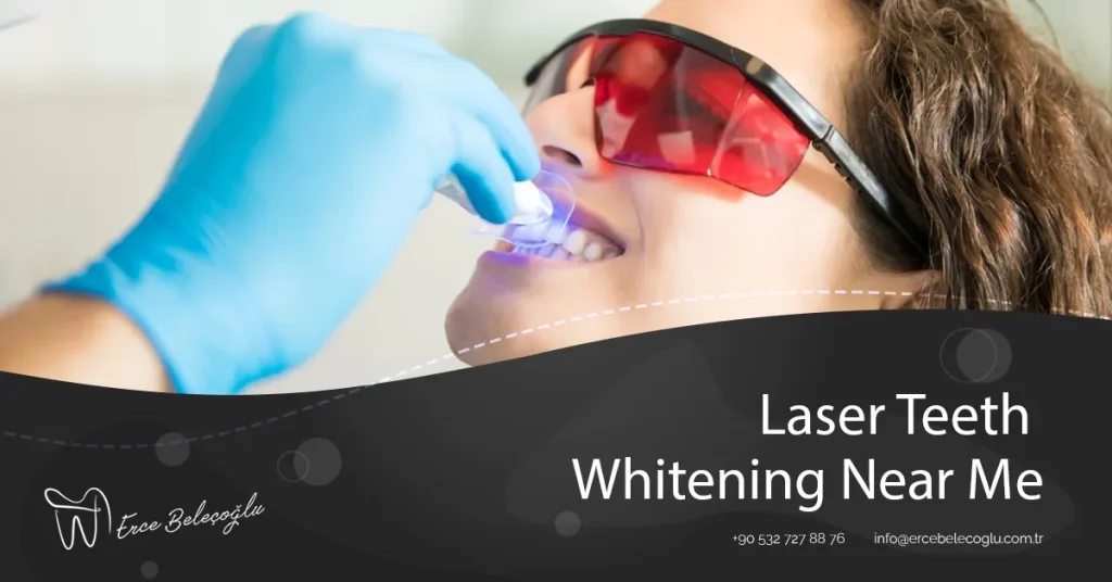 Laser Teeth Whitening Near Me Laser Teeth Whitening Near Me Cost