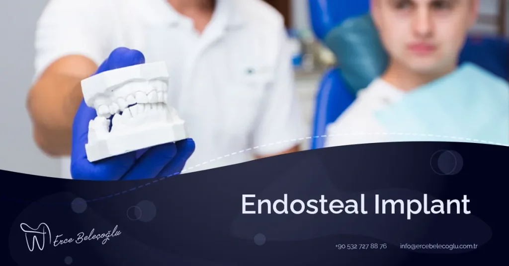 Endosteal Implant