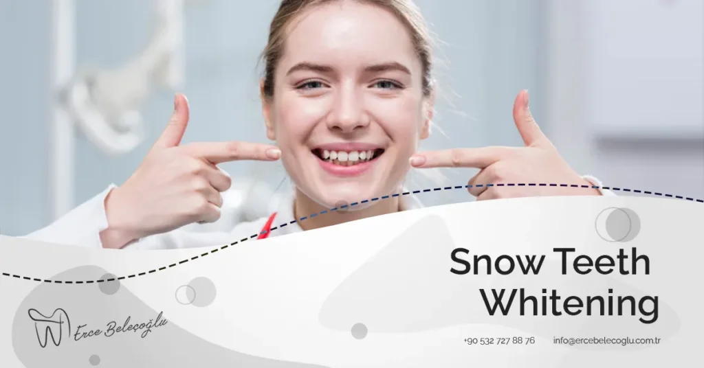 Snow Teeth Whitening