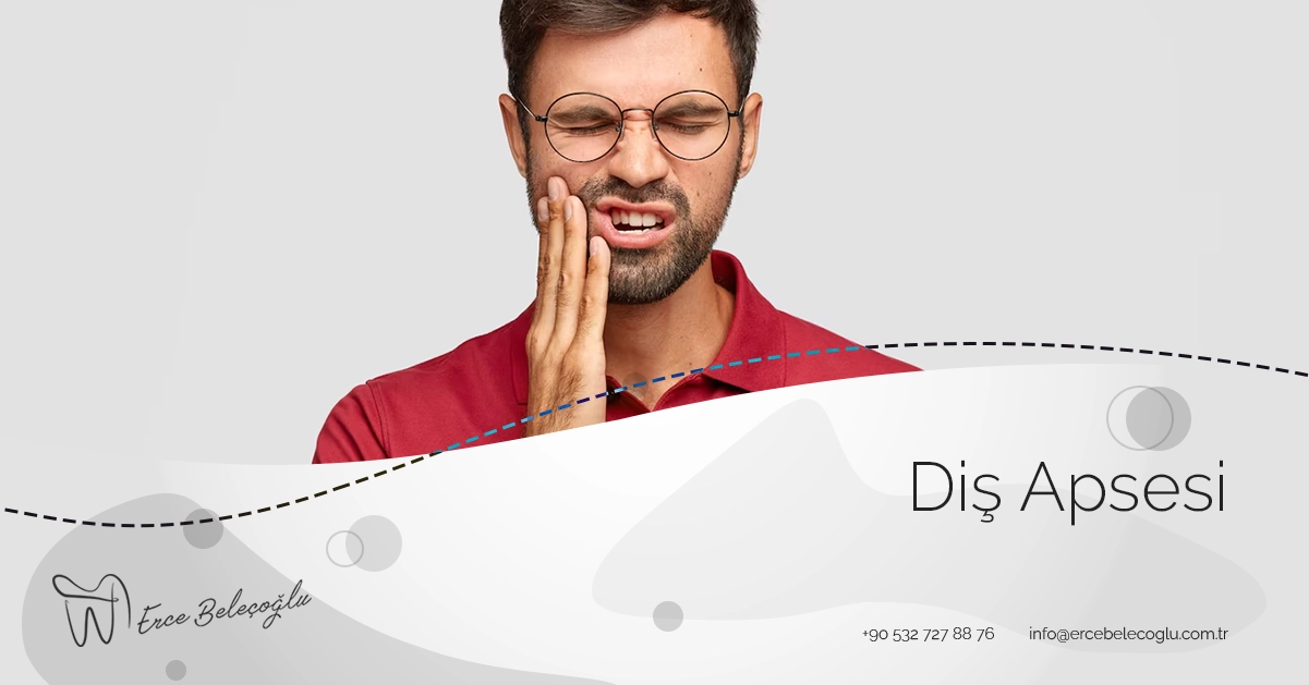 Diş Apsesi