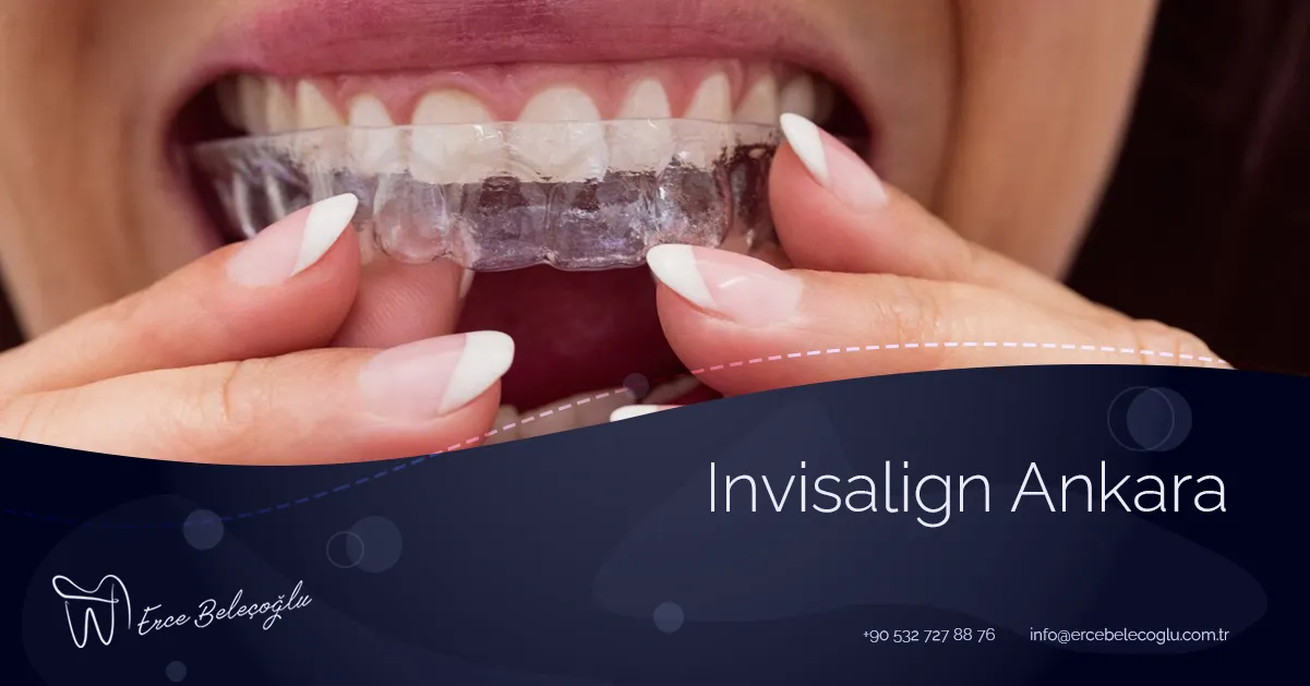 Invisalign Ankara