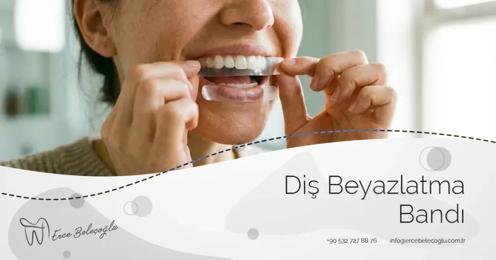 diş beyazlatma bandı 002