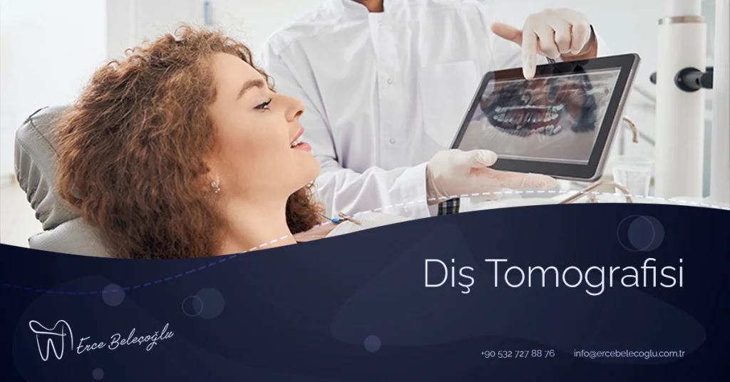 Diş Tomografisi