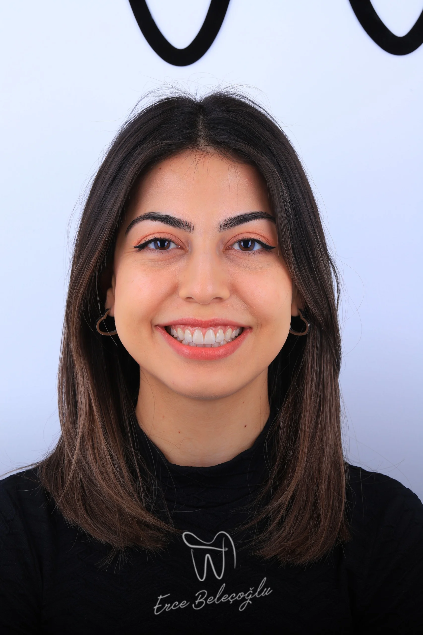 Gummy Smile Gülüş Tasarımı