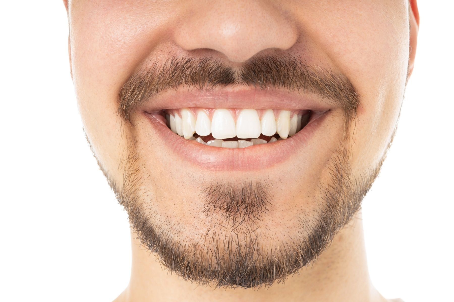 Hollywood Smile