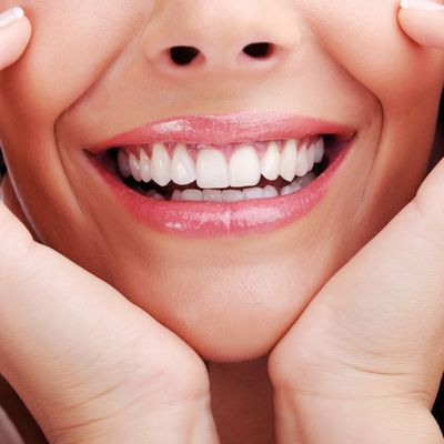 Hollywood Smile
